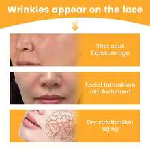 10pcs Smile Line Patch Eye Line Patch Lifting And Firming Skin Facial Mask Eye Mask Application Wrinkle Removing Facial Skin Care - Multicolor - View 5