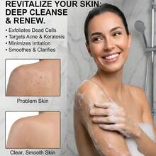 1/2支装硅胶身体去角质刷，男女通用，丝瓜络替代品，柔软硅胶材质，二合一沐浴洗发刷，适合敏感肌肤，可用于背部、淋浴等部位，硅胶去角质清洁刷，硅胶洗发沐浴刷，成人双面摩擦沐浴刷，按摩沐浴刷，浴室清洁工具 - 彩色 - 查看 8