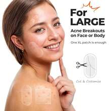 TKTK Large Pimple Patches For Face, 60 X 30 Mm XL Acne Patches, Big Hydrocolloid Bandages For Body, Back, Forehead, Chin, Neck Blemish Zit Breakouts (Oval, Square, Dot 5 Sizes 124 Count) - ColorA - 查看 3