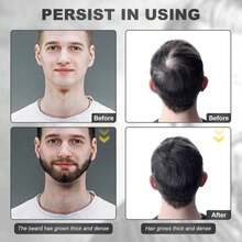 Beard Growth Kit - Beard Kit For Men With Beard Growth Oil (2oz), Beard Balm, Beard Comb, Massager For Spot_Patchy Beard - Christmas, Anniversary, Birthday For Men, Dad, Husband, Boyfriend - White - 查看 7