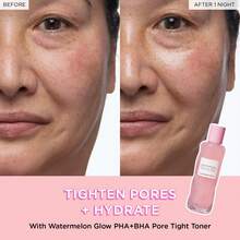 GlowReci pe PHA + BHA Face Toner - Minimizador de poros y exfoliante facial suave coreano para reafirmar, hidratar y exfoliar - Glicerina, agua de sandía y cactus (150 ml) - Rosa sandía - Ver 2