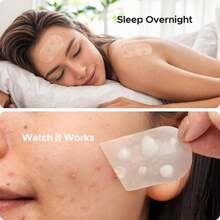 TKTK Large Pimple Patches For Face, 60 X 30 Mm XL Acne Patches, Big Hydrocolloid Bandages For Body, Back, Forehead, Chin, Neck Blemish Zit Breakouts (Oval, Square, Dot 5 Sizes 124 Count) - ColorA - 查看 7