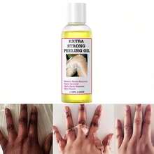 Generic Extra Strong Yellow Peeling Oil For Dark Skin - Exfoliating Solution For Body, Hand, Feet And Face - All Skin Types (110ML/3.88 Fl Oz) - Floral - View 1