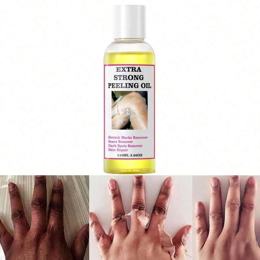 Generic Extra Strong Yellow Peeling Oil For Dark Skin - Exfoliating Solution For Body, Hand, Feet And Face - All Skin Types (110ML/3.88 Fl Oz) - Floral - View 1