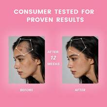 4Pcs Optimal Selection Hair, Skin And Nails Pectin Gummies, 2500 Mcg Biotin Per Serving, Vegetarian Formula, Strawberry Flavor,80 Count, 40 Total Servings - 4 bottles - 查看 5