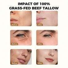 Beef Tallow For Skin - Organic Grass Fed Whipped Moisturizer With Honey Balm, Natural Hydrating Cream For Face & Body, Relief For Dry & Sensitive Skin, 4.23oz - Multicolor - 查看 2