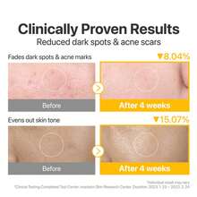 NUMBUZIN No.5 Almohadillas Faciales con Vitamina y Niacinamida - Pads Concentrados con Glutatión, Vitamina CyE - Exfoliación Suave, Iluminador y Antioxidante para Piel Radiante - 180 ml 70 Pads - beige claro - Ver 5