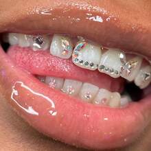 27 pièces Ensemble de décoration de dents en forme de cœur mignon, accessoires de dents de luxe DIY avec faux strass, convient pour le port quotidien, les fêtes, les cadeaux (colle non incluse) - Multicolore - Voir 6