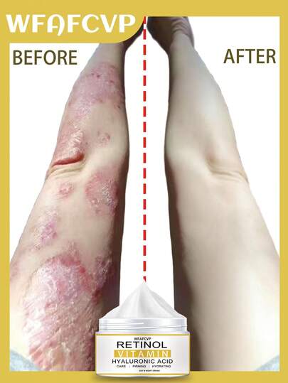 Collagen-Rich Body Lotion, Designed To Firm Skin And Provide Deep Hydration, Suitable For All Skin Types.