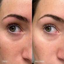 12pcs Collagen Eye Patch Jericho Rose Jelly , Korean Under Eye Patches For Puffy Eyes And Dark Circles, Anti-Wrinkle, Collagen, Caffeine, Niacinamide, Ceramide, Antioxidant, Skin Care - Collagen - 查看 5