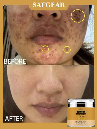 Honey Cream, A Soothing And Moisturizing Cream/Body Butter That Can Be Used For Body And Facial Care, Providing All-Over Hydration.