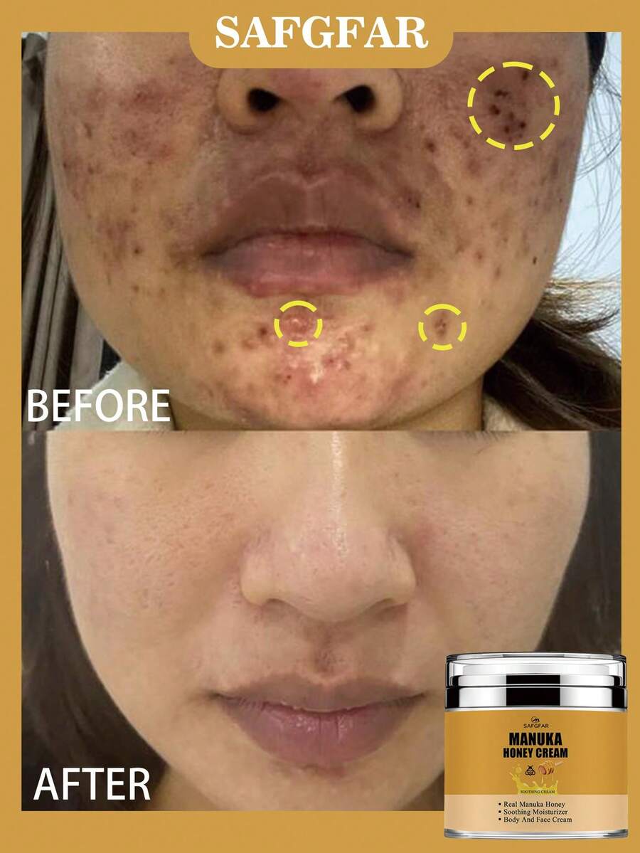 Honey Cream, A Soothing And Moisturizing Cream/Body Butter That Can Be Used For Body And Facial Care, Providing All-Over Hydration.