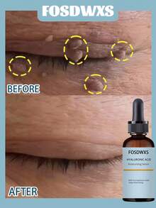 5-In-1 Hyaluronic Acid Moisturizing Essence, Deep Hydration