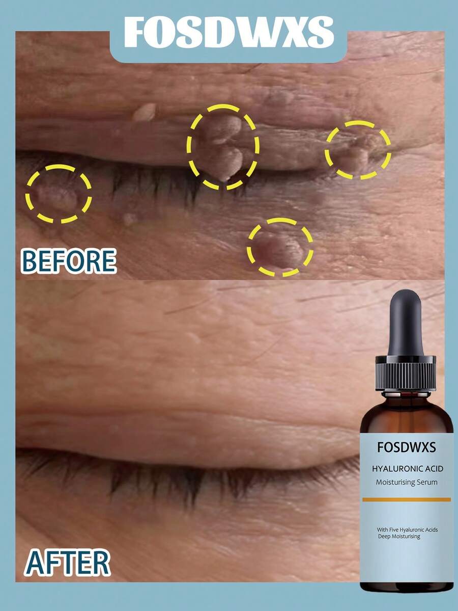 5合1玻尿酸保湿精华，深层补水