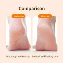 便携式USB充电电动磨脚器 - 足部护理工具，配备3个可替换磨头，打造光滑柔软的双足 - 深层清洁去除老茧 - 白色和粉色设计，家用修脚工具 | 时尚足部护理工具 - 彩色 - 查看 7