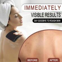 Exfoliating Back Scrubber With Upgraded Handles, Double-Sided Body Scrub Bath Exfoliator, Exfoliating Washcloth For Use In Shower, Back Washer To Deep Clean Your Skin For Men & Women - màu đen - Xem 5