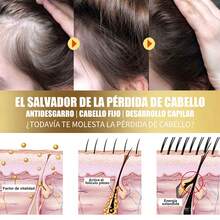 50g Exfoliante rápido para el cuero cabelludo, elimina la grasa, la suciedad, refresca y mejora la sequedad y las molestias. Tratamiento para el control de la grasa del cuero cabelludo, repara la belleza del cuero cabelludo, cuidado del cabello para mujeres y hombres. - Exfoliante para el cuero cabelludo - Ver 5