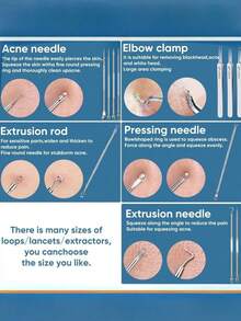 12pcs/9PCS/8PCS/6PCS/5PCS/4PCS/Acne Needle Blackhead Cell Clip Set, Suitable For Pimples, Ingrown Hair Removal, Surface Floating Acne And Blackheads, Very Sturdy And Precise Needle Tips, Less Painful Than Other Acne Tools, Suitable For Professionals And Beginners, Tweezers Set More Sturdy, Not Easily Deformed, Perfect For Facial Blemishes And Pimple Extraction, Beauty Salon Use, Back To School Gift - Multicolor - View 3