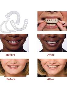 1套硅胶牙齿美白贴片，用于牙齿美白 - 白色 - 查看 3