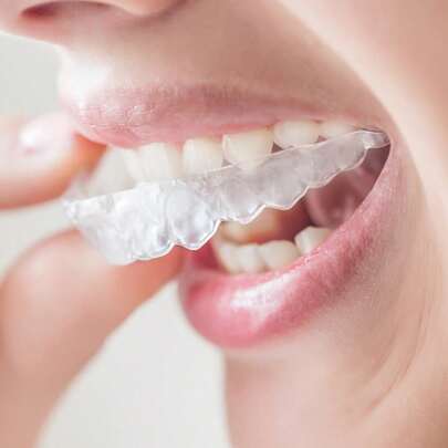 6pcs/Set Transparent Teeth Whitening & Straightening Tray, Odorless Oral Care Accessories, Teeth Protector, Suitable For Men & Women, Ideal Christmas, Thanksgiving, Birthday Gift