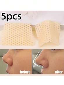 10 piezas de clips nasales autoadhesivos - Almohadillas nasales de contracción por calor a baja temperatura, soporte y fijación externa para fracturas, rinoplastia de fácil aplicación, sin residuos, antideslizante, adecuado para todos los tonos de piel - Multicolor - Ver 12