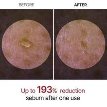 [Dr.Melaxin Official] Peel Shot Glow Rice Ampoule Duo - Serums For Brightening, Exfoliating, And Moisturizing - Suitable For All Skin Types - 水楊酸 - 查看 5
