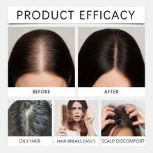 GleamXi迷迭香洗发水 - 温和亲肤，清洁头皮和发根，令秀发柔软蓬松。 - 洗髮水 - 查看 2