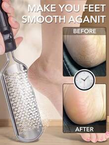 2/4pcs Foot File, Foot Grater, Callus Remover, Professional Foot Scraper, Wet & Dry Foot Crack Dead Skin Remover - Multicolor - View 2