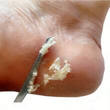 3pcs Stainless Steel Foot Care Set - Professional Callus Remover Tools, Unisex Foot File For Removing Dead Skin And Calluses At Home - Multicolor - View 9