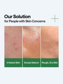 Mediheal Tea Tree Soothing Moisturizing Essence 40ml, Lightweight Non-Sticky Formula, 19,900ppm Tea Tree Extract Instant Soothing, 2,800ppm Hyaluronic Acid Deep Hydration, Suitable For Sensitive And Oily Skin - Tea Tree Soothing Serum - View 6