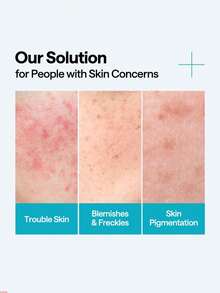 Mediheal 40毫升积雪草修护精华，舒缓净化精华，适合敏感肌肤。40毫升/1.35液体盎司 - Centella Asiatica Clear Repair Serum - 查看 6