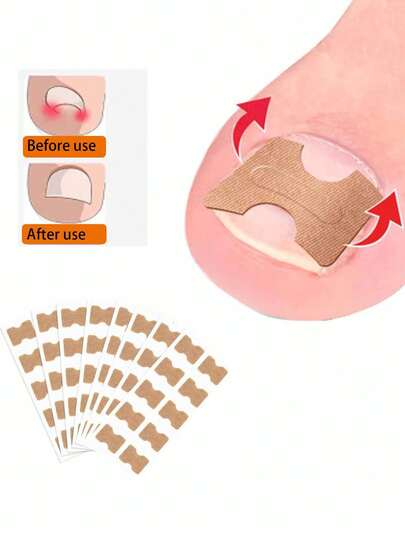 10片/包脚趾甲矫正贴（1包内含10片），无胶嵌甲矫正贴，指甲护理工具