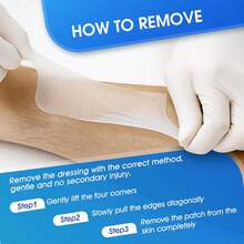 Rolo de Hidrocolóide para Cobertura de Cicatrizes - Corte sob Medida, Bandagens de Hidrocolóide Impermeáveis com Autoadesivo, Ultra Absorvente e Flexível, 5cm X 150cm - Multicolorido - Visão 9