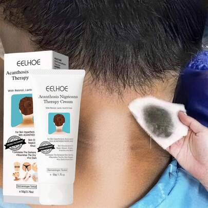 Body Cream Dark Spot Corrector Elbows Knees Hydrating Moisturizing Dry Skin Care Brightening