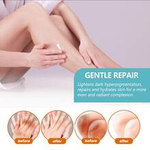 Body Cream Dark Spot Corrector Elbows Knees Hydrating Moisturizing Dry Skin Care Brightening - Kem dưỡng thể Blackthorn - Xem 7