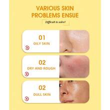 16PCS Turmeric Lemon Kojic Acid Soap (100g Each), Suitable For Face, Body, And Cleansing. Handmade Soap With Rich Lather, Deeply Cleanses And Softens Skin. Handcrafted, This Facial Soap Helps Fade Dark Spots And Remove Blackheads. It Deeply Cleanses And Moisturizes, Rich In Curcumin, Vitamin E, And Rose Extract. Suitable For Face And Body, Its Formula Is Natural And Gentle. - Lemon - Xem 3