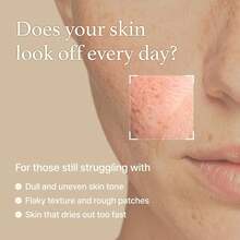 I'M FROM Rice Toner, Glowing Skin, Glow Essence With Niacinamide, Hydrating For Dry, Dull, Combination Skin, 5.07 Fl Oz - Mực toner - Xem 2