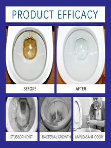 jakehoe 1 Botella de 120ML Limpiador de espuma para inodoro, elimina olores, manchas y acumulación de ácido úrico, limpieza profunda para el inodoro, mantiene el inodoro fresco y desinfectado, entrega aleatoria de versiones nuevas y antiguas - Líquido - Ver 9