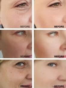 60毫升护肤面部精华套装 - 维生素C精华（亮肤）、视黄醇精华（抗皱） - 白色 - 查看 3