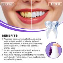 30ml V34 Teeth Whitening Toothpaste Serum, Tooth Colour Corrector Foam Remove Yellow Stains Tartar Oral Hygiene Cleaning Dental Bleaching Tools Fresh Breath Tooth Whitener Care Essence - Teeth Whitening Serum - 查看 3