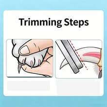 这是一套猫咪指甲修剪套装，包含宠物指甲钳、指甲磨刀器和猫咪清洗袋。指甲钳猫狗均适用。 - 彩色 - 查看 5