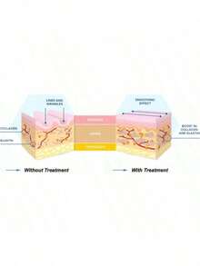 LifeCell - Men: See Tighter Looking Skin In ONE Easy Step-HHYD - 1 chiếc - Xem 4