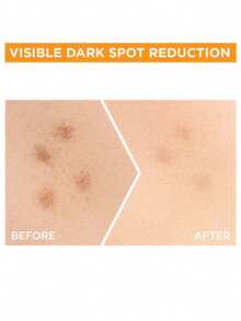 Garnier 卡尼尔亮白维C精华液，淡化色斑，减少色素沉着，提亮肤色，夜间精华，改善暗沉，蕴含10%纯维C，质地轻盈，抗氧化，保湿修护，令肌肤焕发光彩，适合夜间护肤 - 15ml - 查看 2