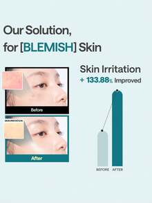 Mediheal 积雪草修复面膜，一款温和舒缓的面膜，能够滋养肌肤，缓解敏感，并增强皮肤屏障。 - Centella - 查看 4