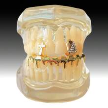 一套男女通用水钻十字架火焰牙套，适合日常休闲和派对佩戴 - 彩色 - 查看 2