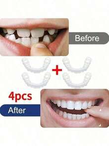 4 piezas/5 piezas Herramientas dentales, Dentaduras cosméticas cómodas y ajustables: Dientes superiores e inferiores, Crea una sonrisa segura y encantadora - Multicolor - Ver 9