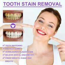 30ml V34 Teeth Whitening Toothpaste Serum, Tooth Colour Corrector Foam Remove Yellow Stains Tartar Oral Hygiene Cleaning Dental Bleaching Tools Fresh Breath Tooth Whitener Care Essence - Teeth Whitening Serum - 查看 4