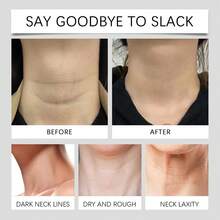 Instant Firming Neck Tape - Lifting Firming Enhance Skin Elasticity Reduce Sagging Skin Fade Fine Lines Anti-Wrinkle Improve Skin's Smoother Invisible Easy Wear - 20 Patches/Box - Neck Tape - View 10