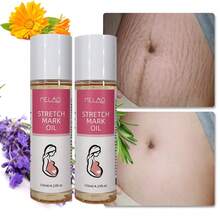 2 Bottles MELAO Firming Body Oil, Specially Designed For Stretch Marks, Stretch Mark Care Oil And Abdominal Care Oil, Suitable For Pregnancy And Postpartum, Containing Natural Plant Oils, Fading Stretch Marks, Firming Skin, 125ml - Rose Red - View 1
