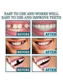 4 piezas/5 piezas Herramientas dentales, Dentaduras cosméticas cómodas y ajustables: Dientes superiores e inferiores, Crea una sonrisa segura y encantadora - Multicolor - Ver 6